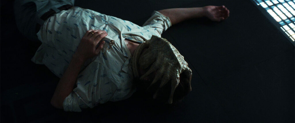 Alien: Earth - Arthur with a Facehugger on his face