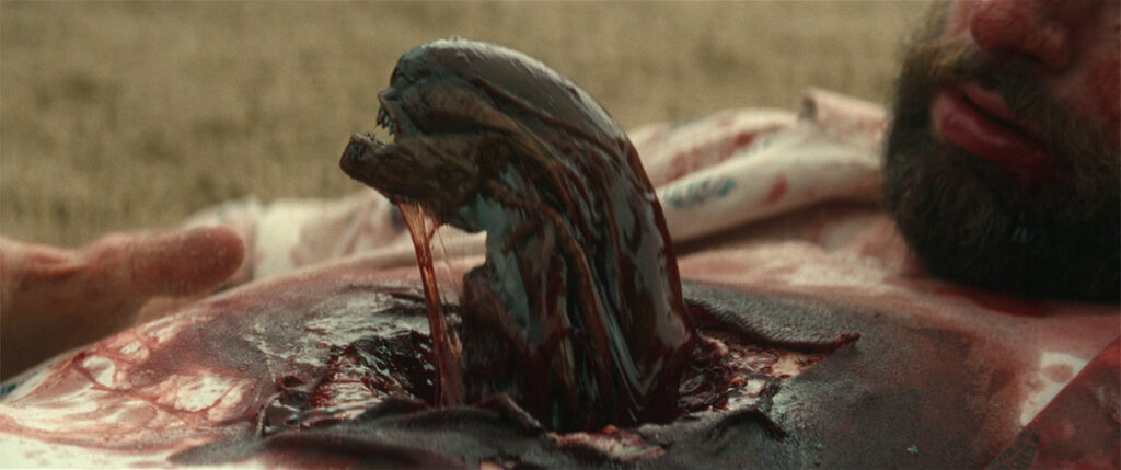 Alien: Earth - A chestburster rips Arthur open
